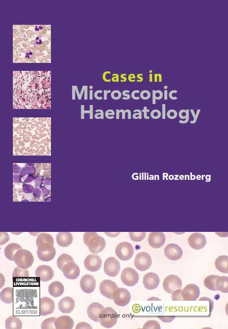 atlas of hematology pdf